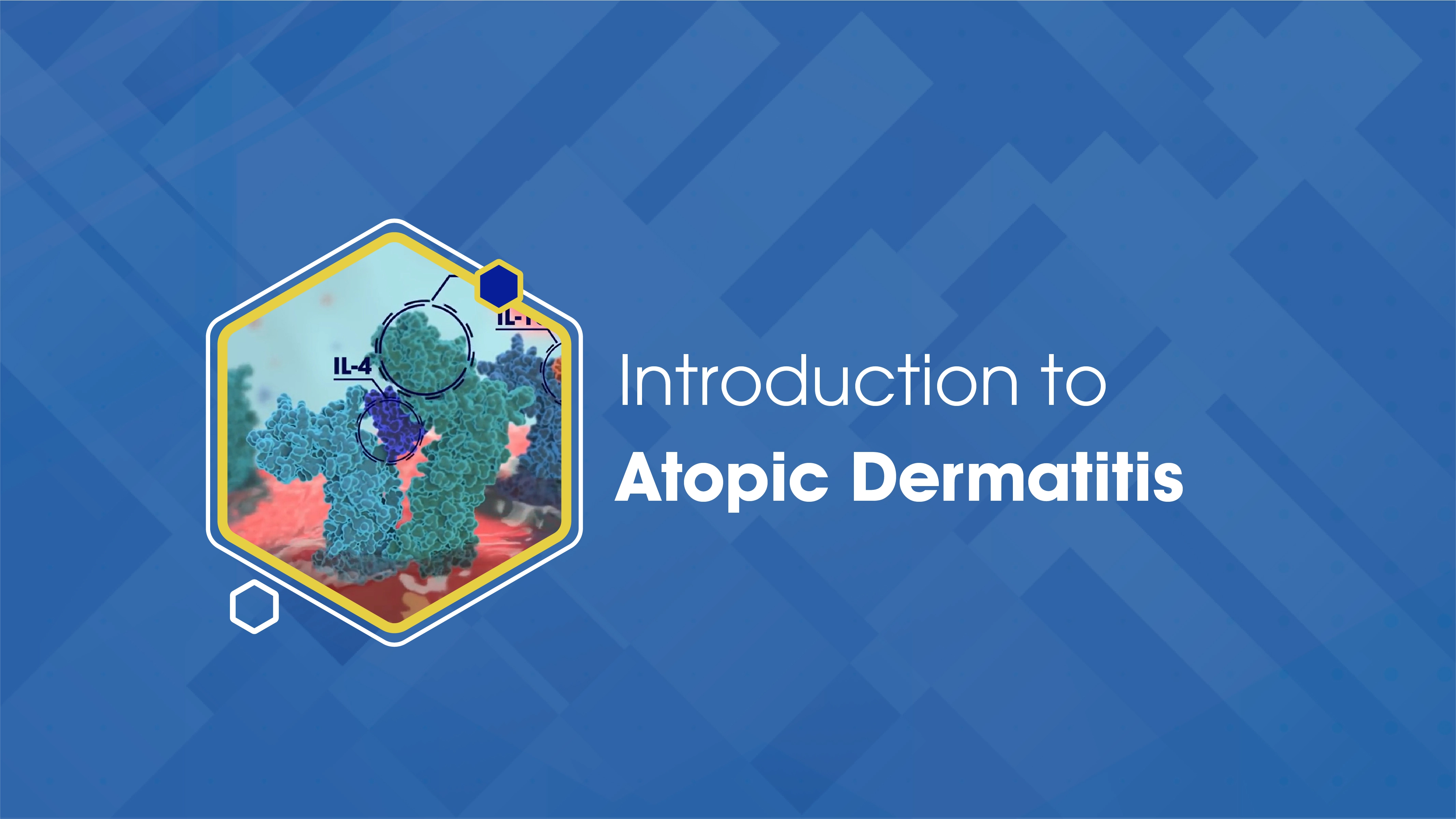 Introduction to Atopic Dermatitis